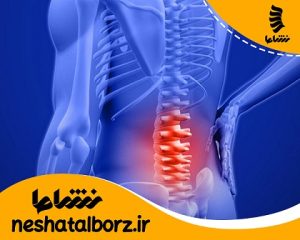 فیزیوتراپی کمر درد در فردی سکرج