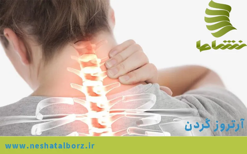 آرتروز گردن
