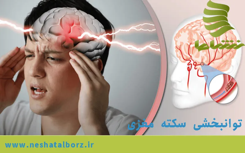 توانبخشی سکته مغزی