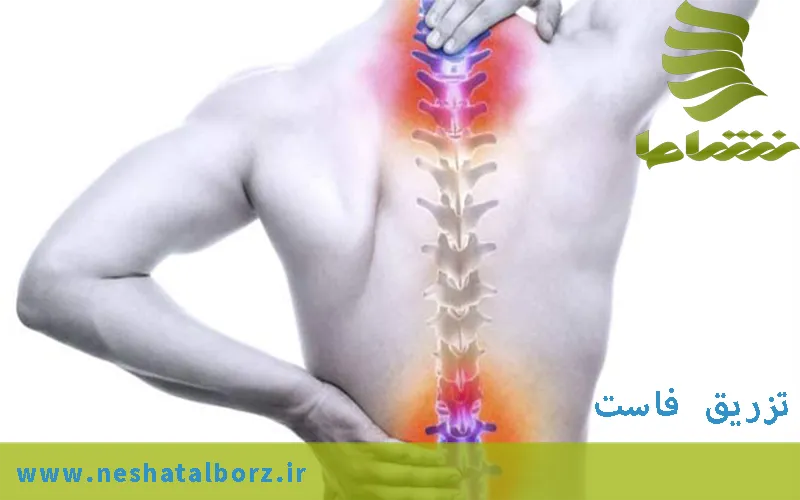 تزریق فاست چیست