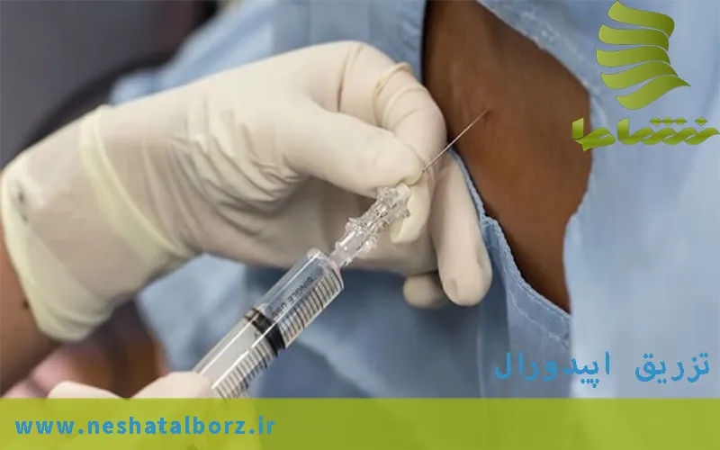 تزریق اپیدورال - نحوه انجام این تزریق - موارد استفاده