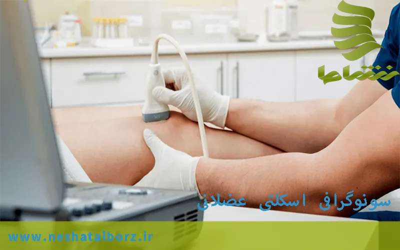 سونوگرافی عضلات اسکلتی