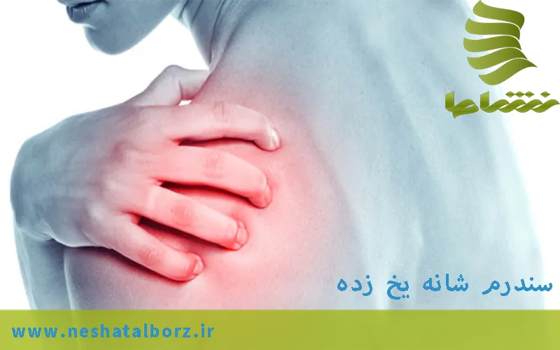 سندرم شانه یخ زده یا کپسولیت چسبنده