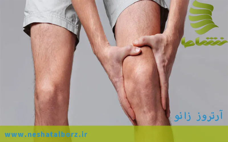 آرتروز زانو - درمان آرتروز زانو در فردیس کرج