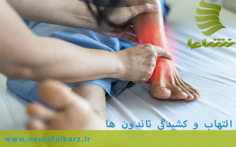 تاندونیت(التهاب و کشیدگی تاندون ها)