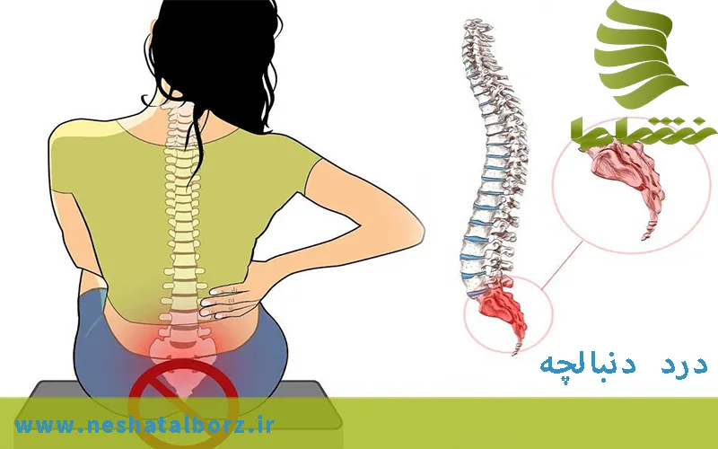 درد استخوان دنبالچه یا کوکسیدینیا