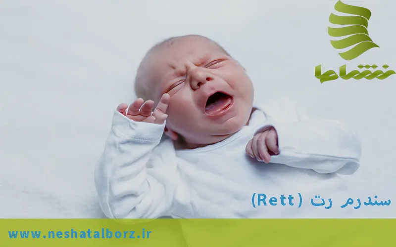 سندرم رت (Rett) و روش های درمانی