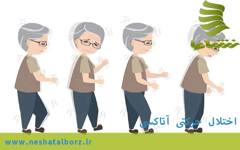 اختلال حرکتی آتاکسی