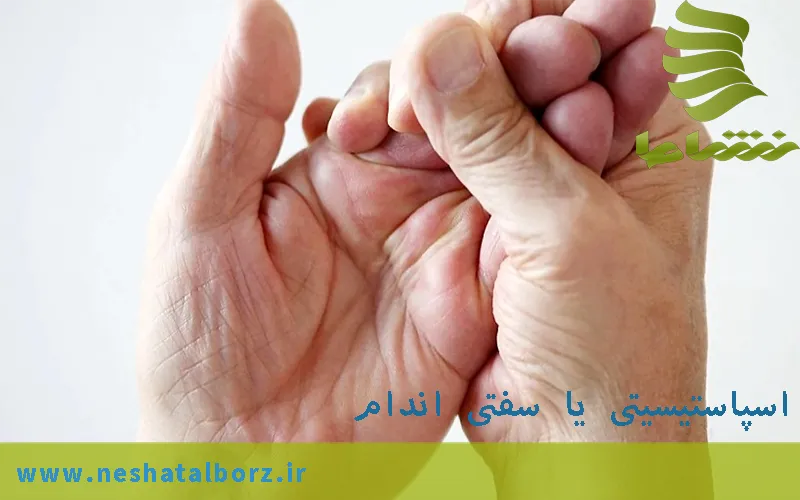 اسپاستیسیتی یا سفتی اندام