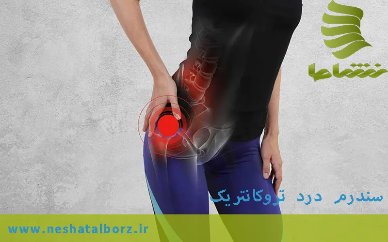 سندرم درد تروکانتریک