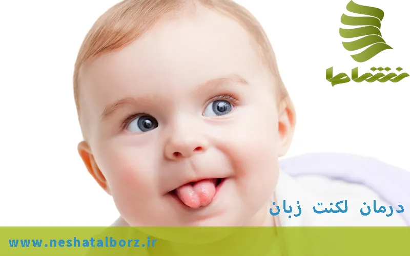 لکنت زبان