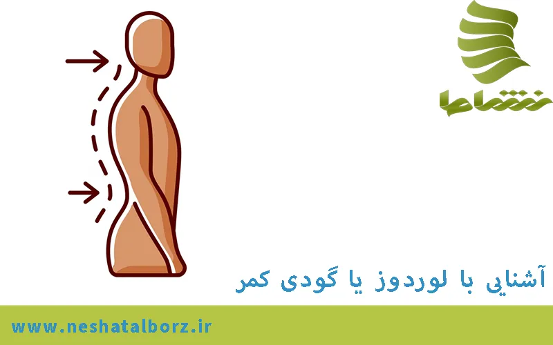 آشنایی با لوردوز یا گودی کمر