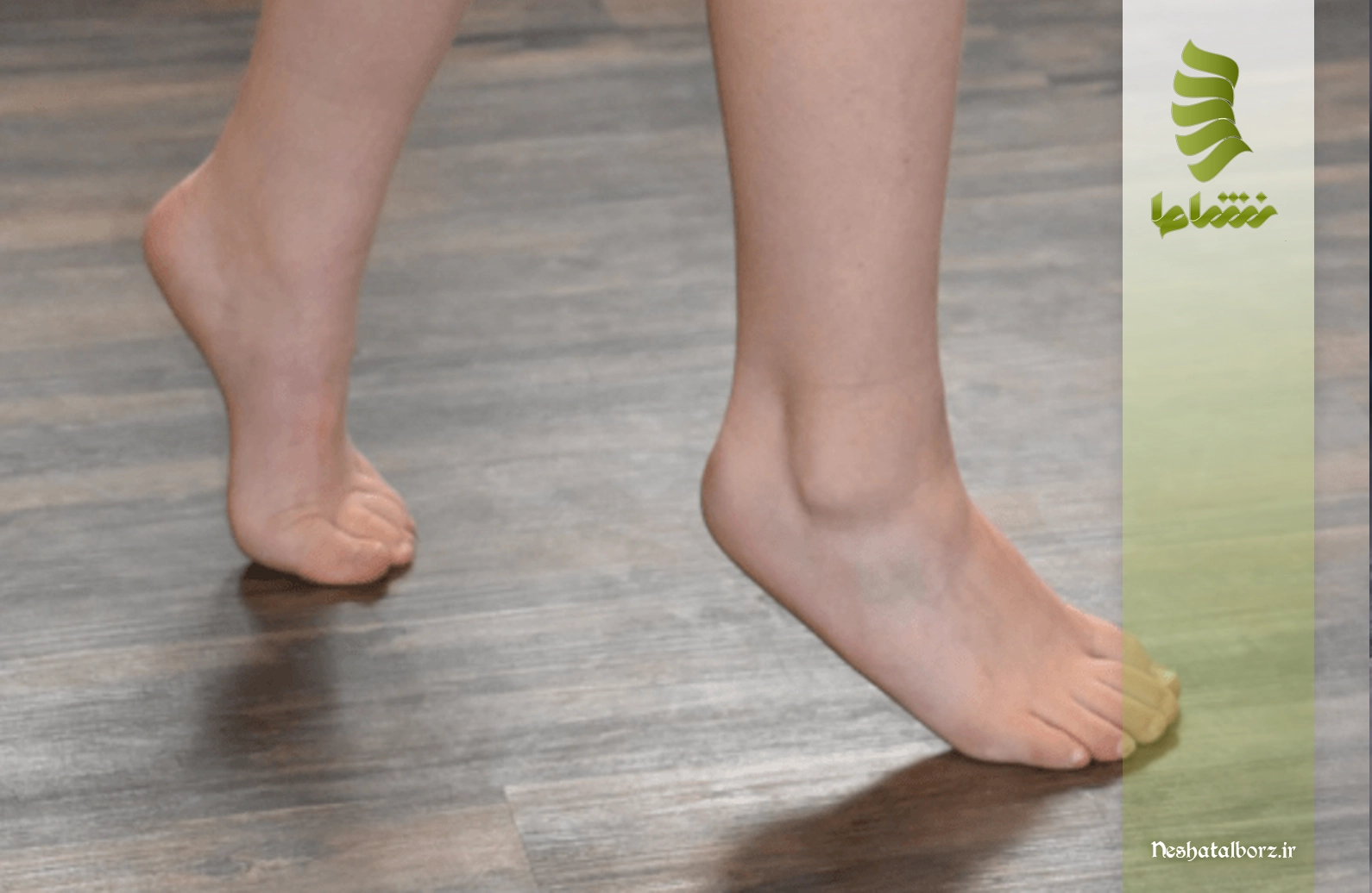 دلیل راه رفتن کودک روی نوک پا