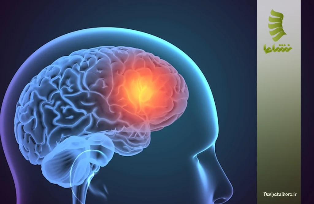 درمان آسیب مغزی ثانویه