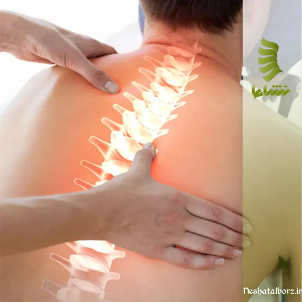 بهترین متخصص دیسک کمر در فردیس کرج
