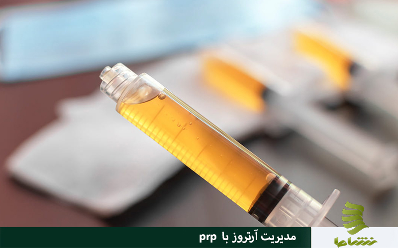  آرتروز با PRP