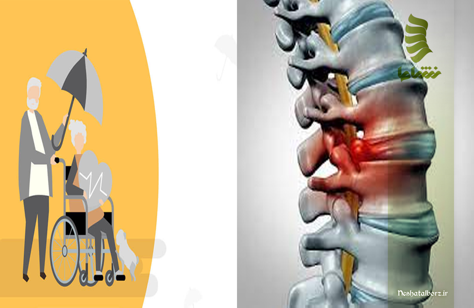 کلینیک تخصصی استخوان و مفاصل تحت پوشش بیمه در فردیس