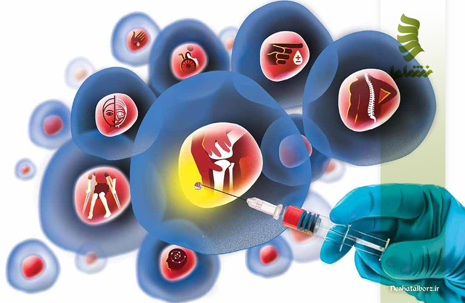 درمان آرتروز و مفاصل با سلول های بنیادی