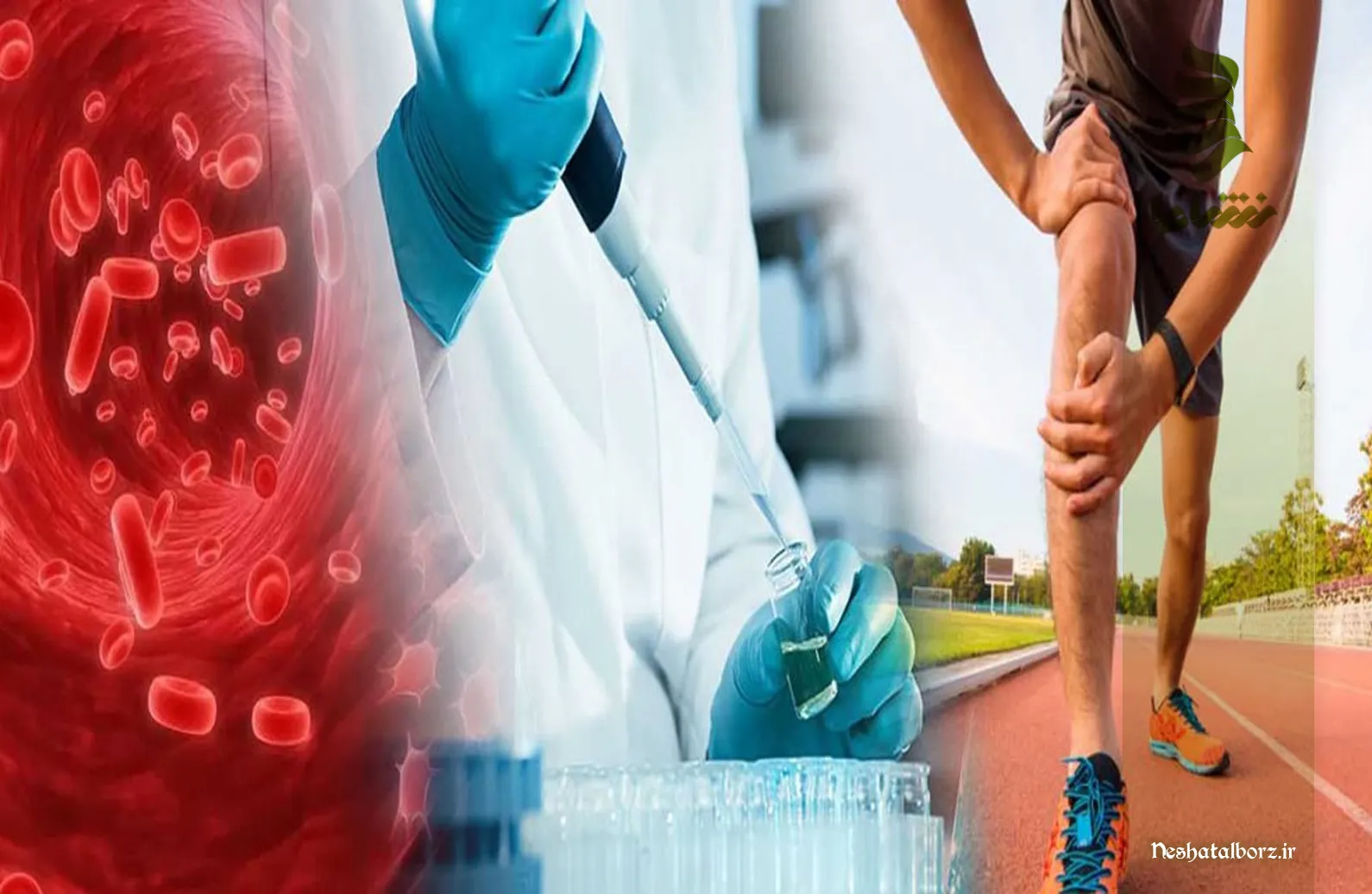 تحولی در درمان مشکلات استخوان و مفاصل با استفاده از روش PRP