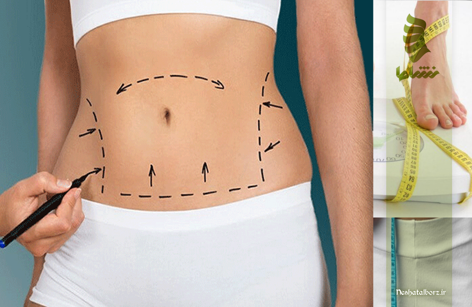 بهترین مرکز طب سوزنی در فردیس کرج