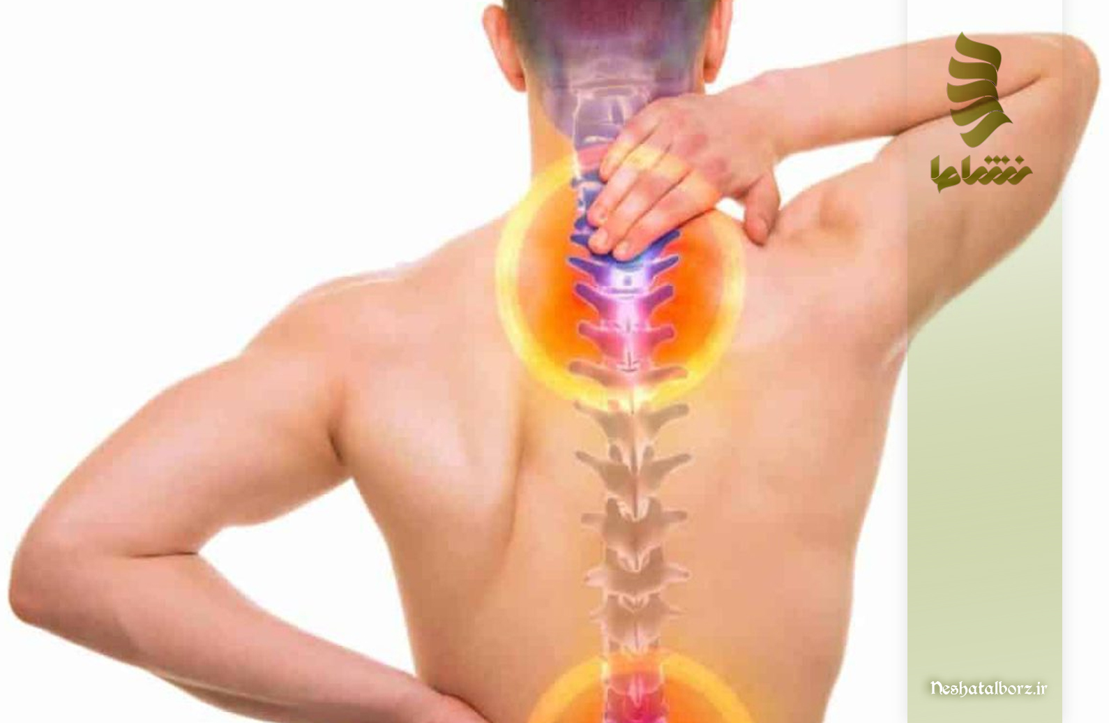 فیزیوتراپی و توانبخشی دیسک گردن راهی برای جلوگیری از جراحی