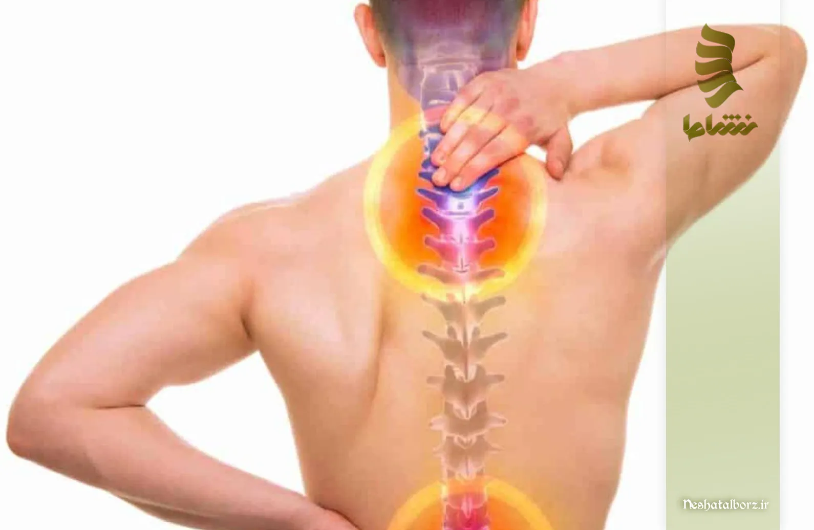 فیزیوتراپی و توانبخشی دیسک گردن راهی برای جلوگیری از جراحی