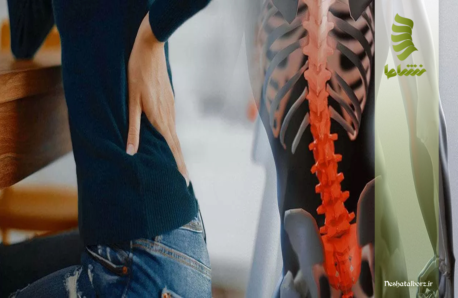 نکات مشترک در پیشگیری از دیسک کمر و سیاتیک