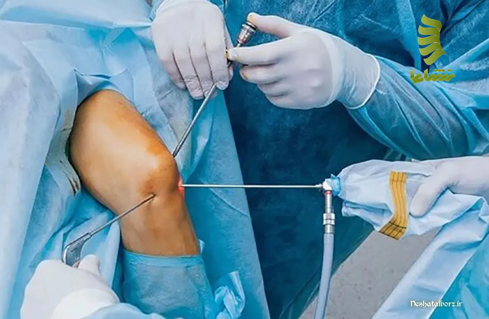 بررسی پزشکی قفل شدن زانو و راهکارهای مقابله با آن
