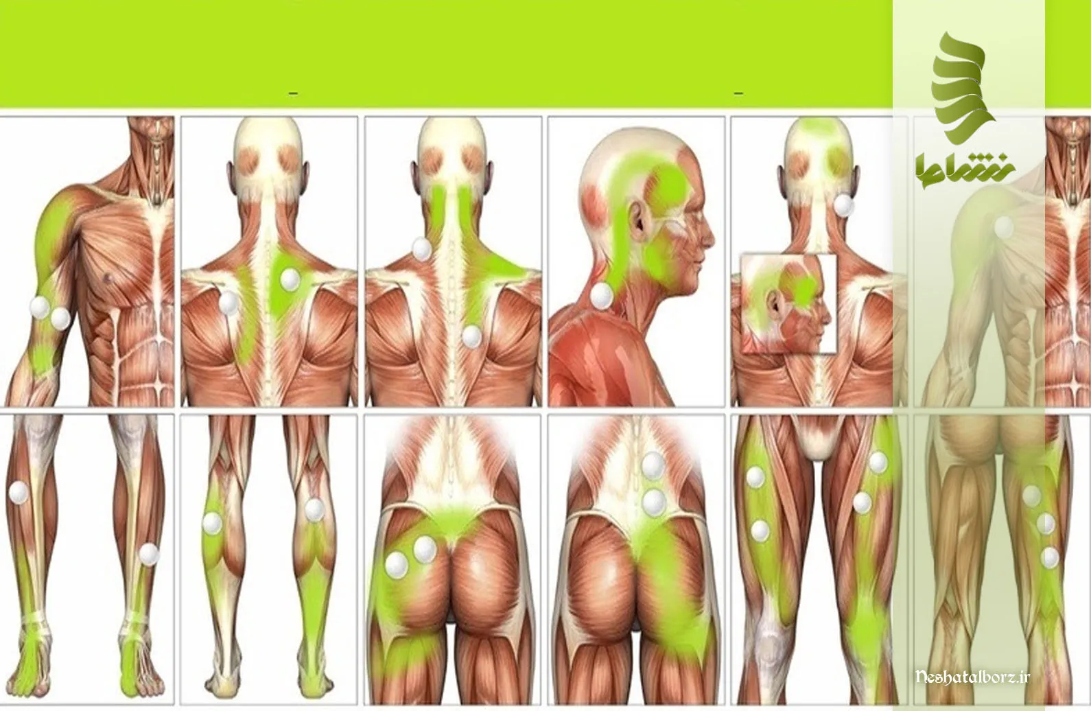 نقاط ماشه ای بدن و تأثیر آن‌ها بر عملکرد روزانه و درمان و پیشگیری