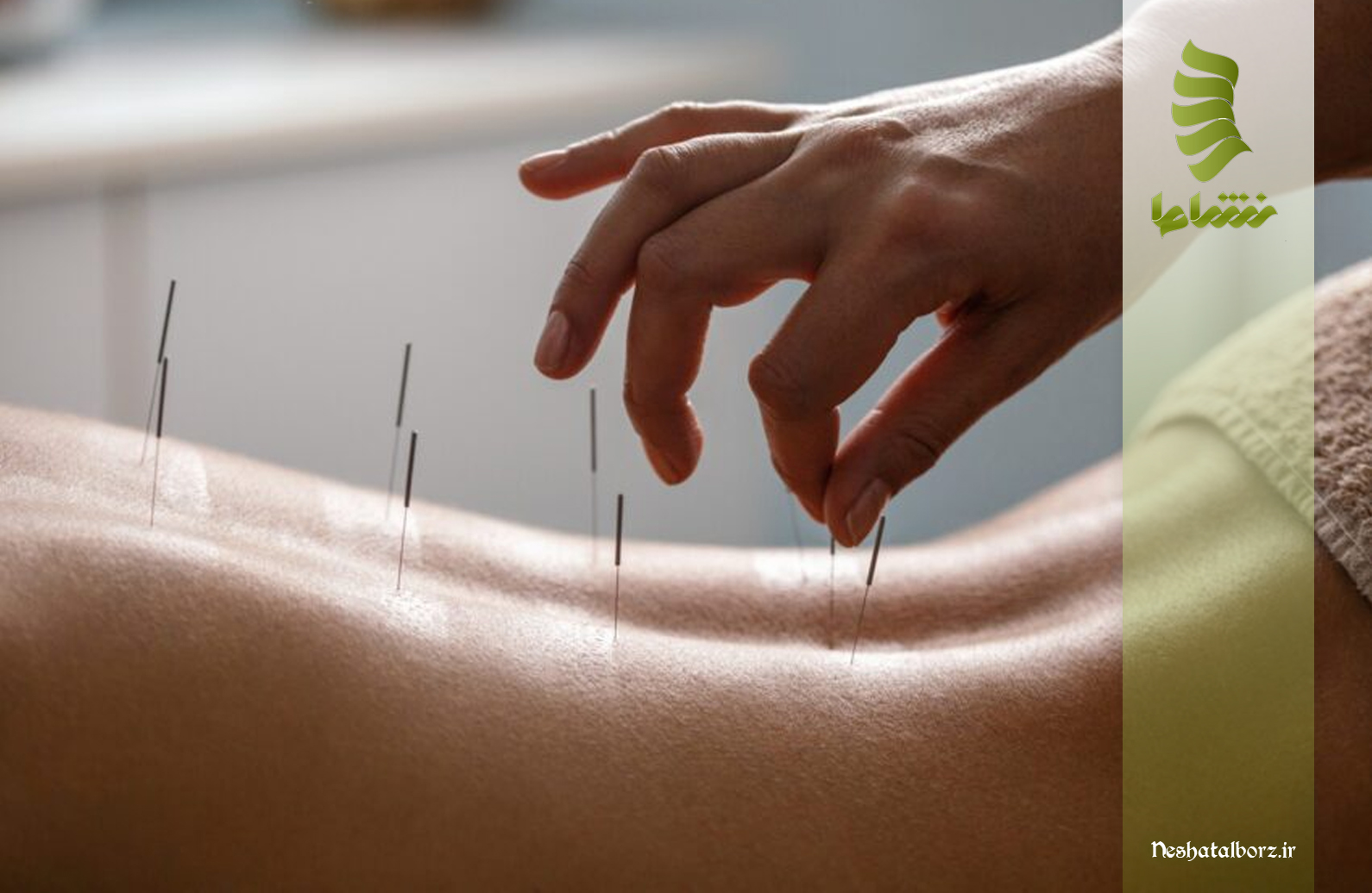 تاثیر طب سوزنی بر درمان سیاتیک