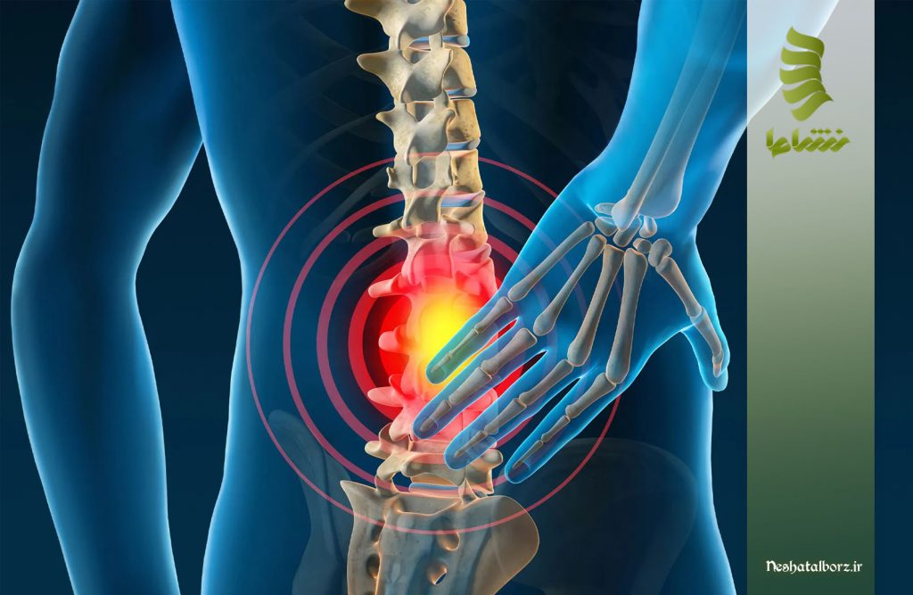 دیسک کمر خود به خود خوب میشود؟