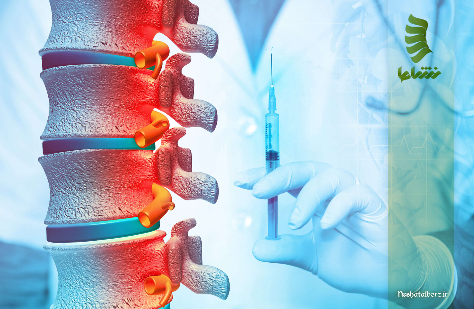 تزریق پی آر پی به کمر | نحوه تزریق، مزایا و فواید