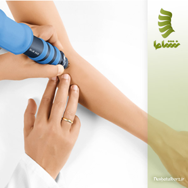 شاک ویو تراپی برای درمان آرنج تنیس بازان در فردیس