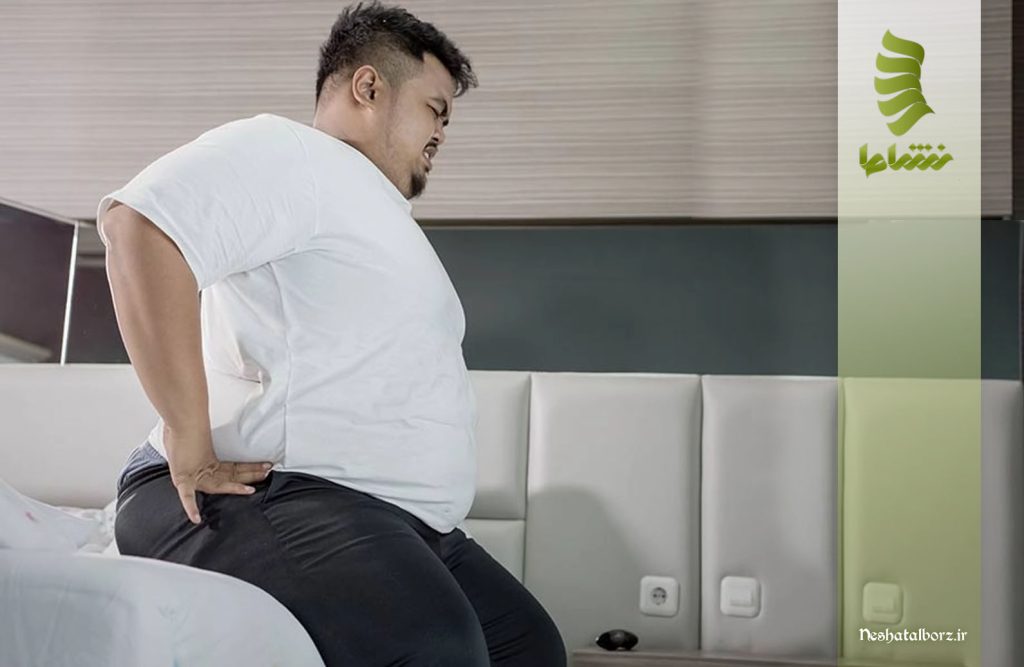 تاثیر کاهش وزن بر درد سیاتیک