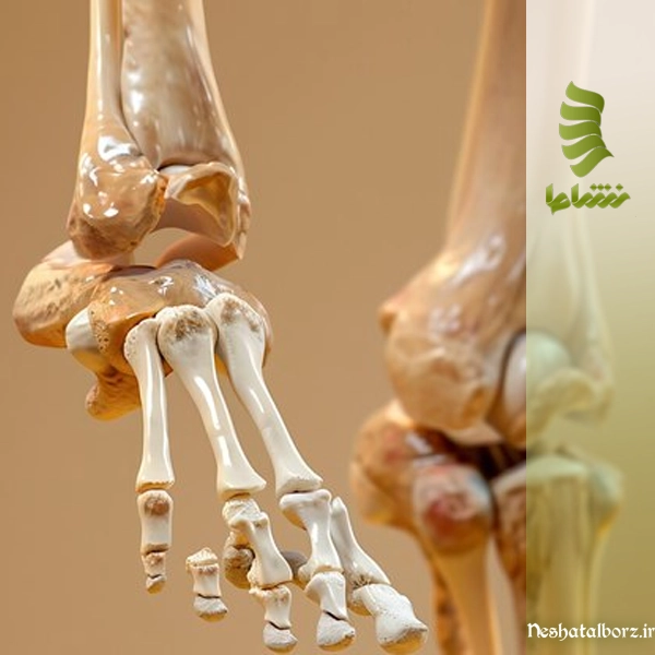 کلینیک تخصصی استخوان و مفاصل تحت پوشش بیمه در فردیس