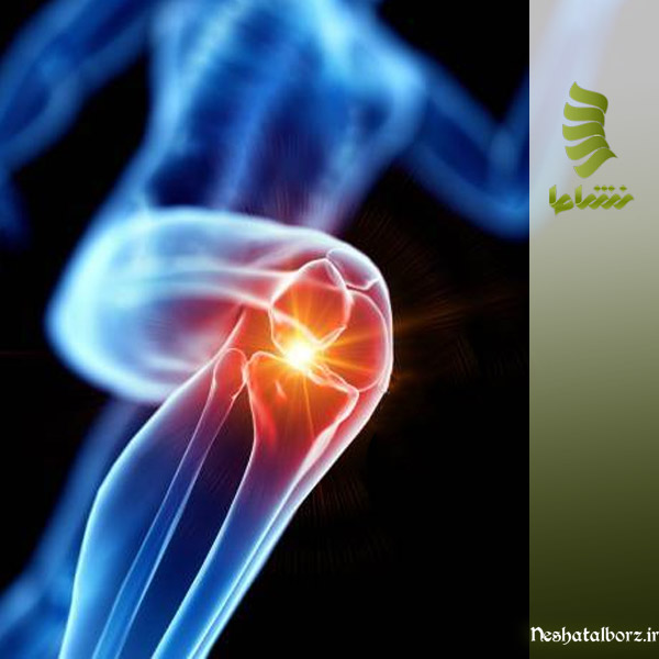 تاثیر اضافه وزن بر درد زانو | راه‎‌های درمانی