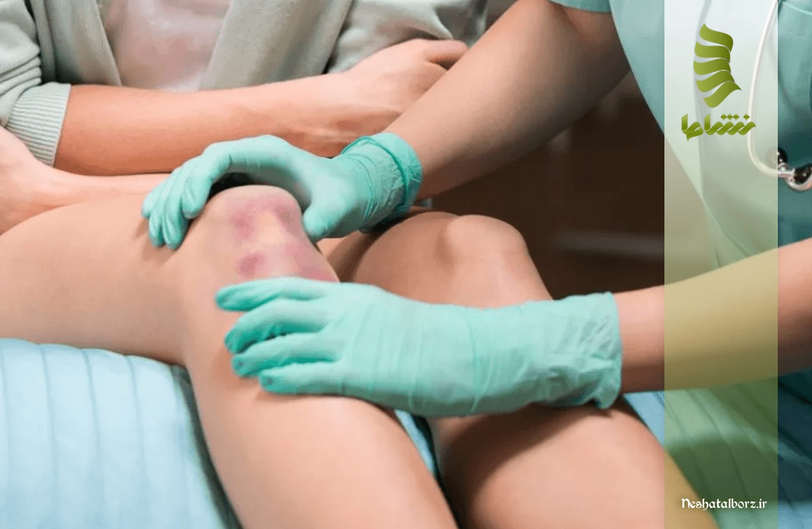 متخصص زانو درد فردیس کرج