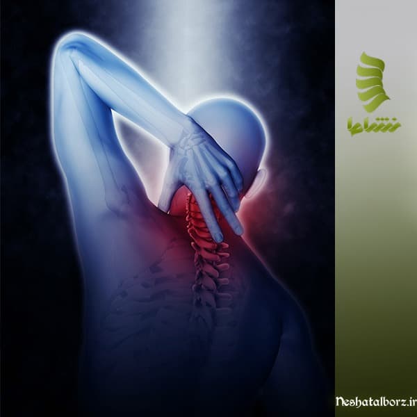 درمان میوزیت با فیزیوتراپی و تغذیه