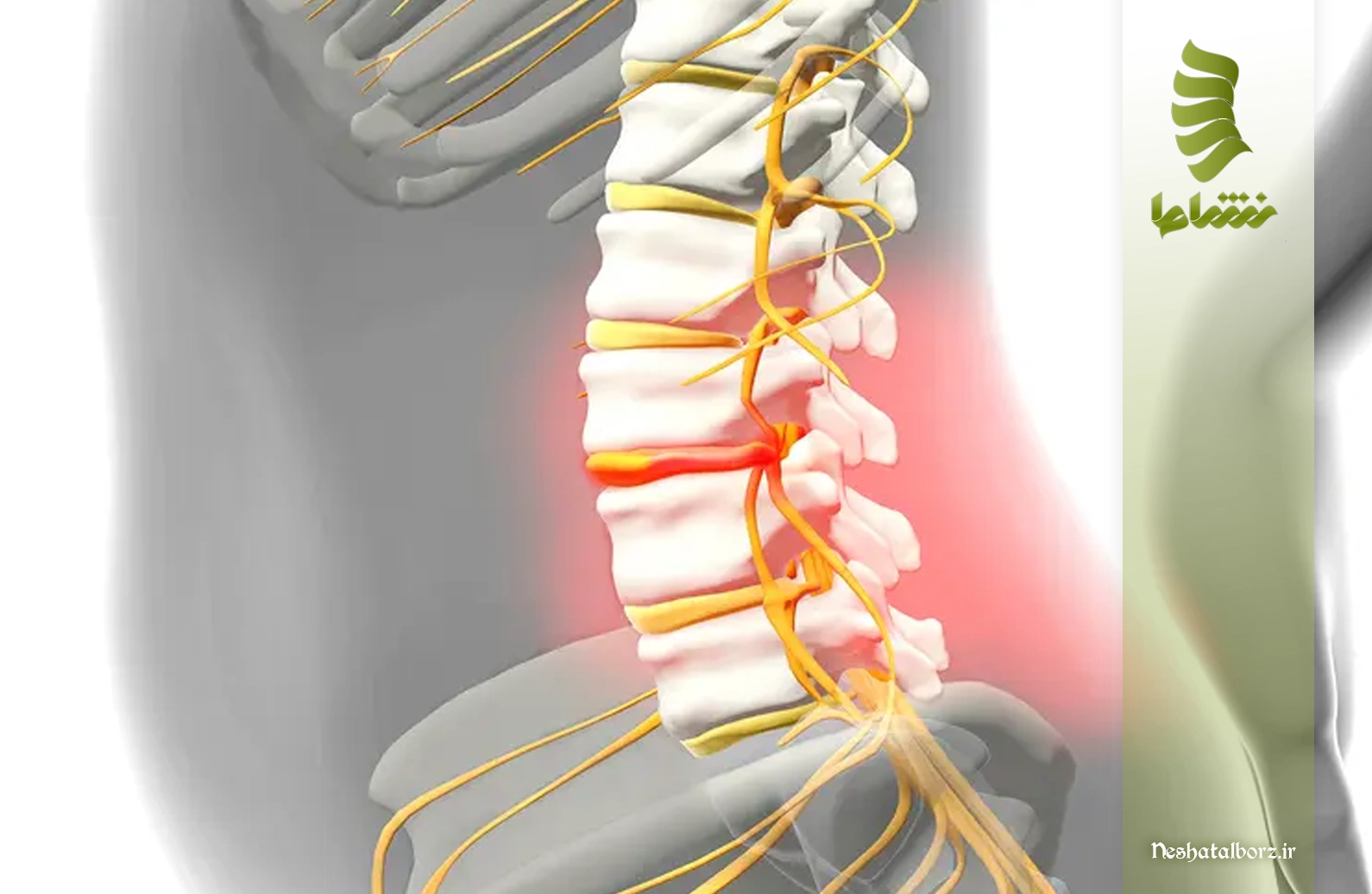 درمان سندرم دم اسبی