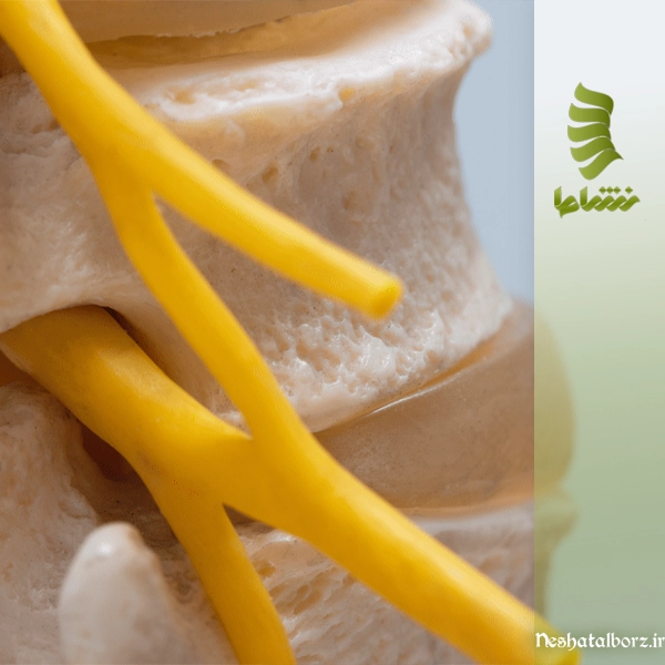 سندرم دم اسبی | از علائم تا درمان