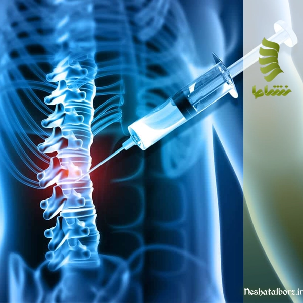 مراقبت های بعد از تزریق دیسکوژل