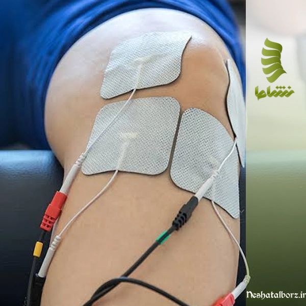 فیزیوتراپی با برق در کرج