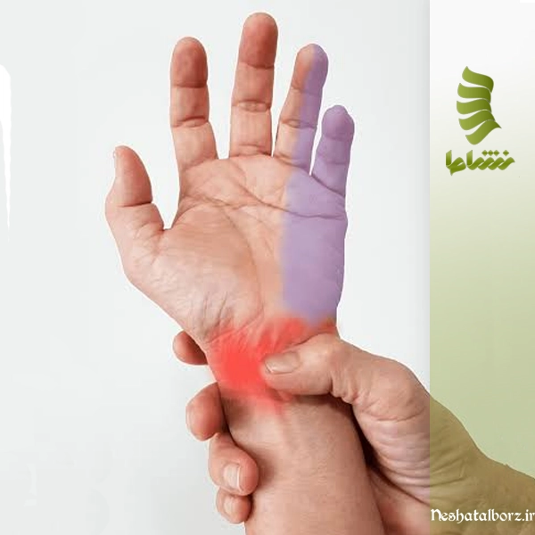 بی حسی بعد از فیزیوتراپی؛ علت و روش‌های درمان