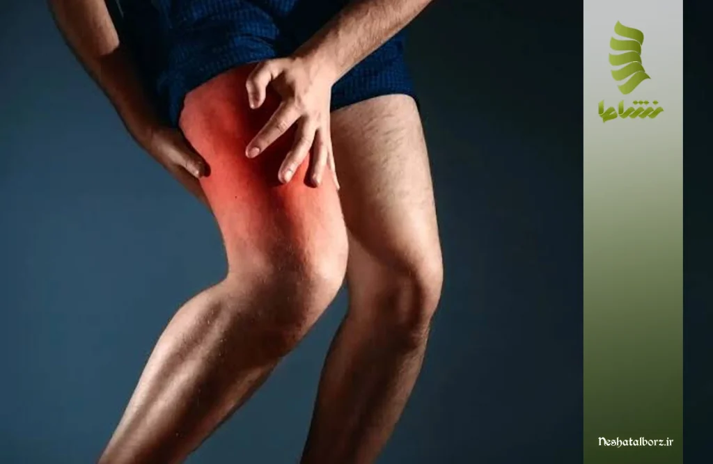 علت گرفتگی عضلات بعد از فیزیوتراپی